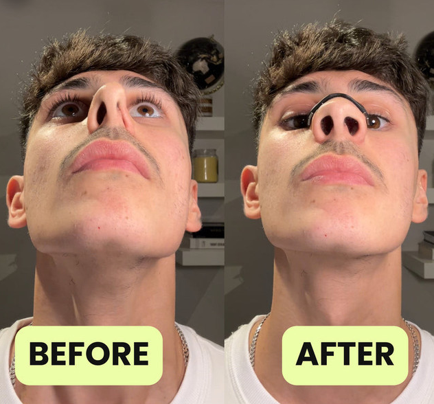 Air Bloom Magnetic Nose Stips